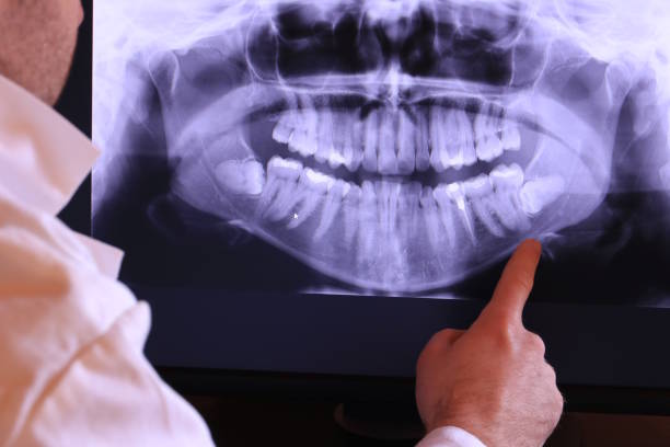 Best Weekend Emergency Dentist in Frankenmuth, MI