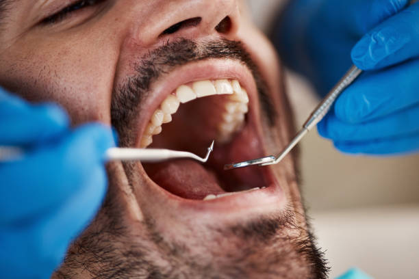 Best Emergency Root Canal Treatment in Frankenmuth, MI